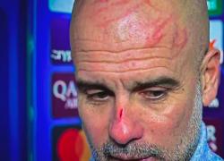 Guardiola con graffi in testa: "Voglio farmi del male", l'allenatore si è ferito da solo dopo il pareggio con il Feyenoord - VIDEO