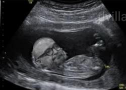 Maria Rosaria Boccia incinta di Gennaro Sangiuliano? "Ecco a chi assomiglia il bambino dalle ecografie" - FOTO
