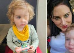Bimbo diventa cieco a 2 anni, la mamma: "Baciato da un estraneo con herpes alle labbra, il virus è arrivato fino alla cornea"