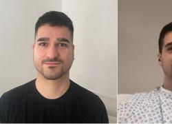 Uk, il 36enne George Dudnik: "Mi hanno diagnosticato un cancro ai polmoni al quarto stadio a novembre 2024, avevo il viso gonfio e per i medici era parotite"