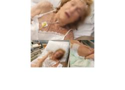 Ospedale lager Milano? Ultranovantenne innocua ricoverata per bronchite, prima legata e poi talmente sedata da non riuscire più a parlare - VIDEO