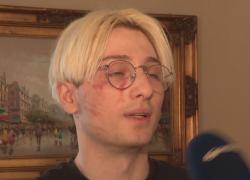 Milano, ragazzo preso a martellate in testa per 30 euro da baby gang di nordafricani: “Scusa fra, noi ci guadagniamo da vivere così”