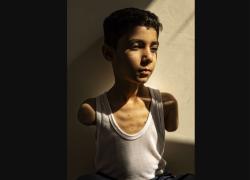 Gaza, il REPORT Onu: "Oltre 21mila bambini palestinesi con disabilità permanente dal 7 ottobre, più di 41mila minori feriti in due anni"