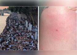Francia, ritorno del “Needle Spiking”, oltre 145 persone denunciano punture durante “Festa della Musica”, ipotesi iniezione droga dello stupro