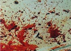 Omicidio Nada Cella, in una foto ingrandita mostrata in aula le tracce lasciate dall’arma del delitto