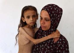 Gaza, aumentano le vittime per la carestia causata da Israele, ministro Salute palestinese: "289 morti per fame tra cui 115 bambini"
