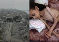 Gaza, Unrwa contro Israele: "A causa delle bombe, carestia e terre distrutte, 1kg di pomodori costava 60 centesimi, ora 15 $, famiglie senza cibo né reddito"