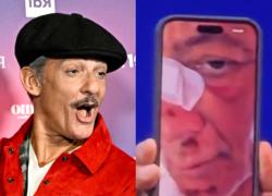 Incidente in bici per Fiorello: "Sono caduto di faccia, ho usato il freno davanti in una lunga discesa che porta al secondo cancello" - VIDEO