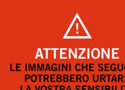 Gaza City, 3 bambine palestinesi ferite da raid Idf nel quartiere di Sheijaya, insanguinate e bendate dai medici - VIDEO