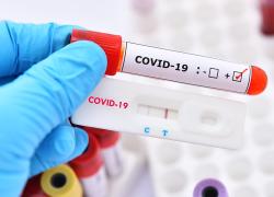 Covid, biologi tedeschi: "L'86% dei test Pcr positivi non rappresentavano infezioni reali, infetti sovrastimati per anni" - lo STUDIO