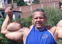 Addio ad Arlindo de Souza &ldquo;Anomalia&rdquo;, morto a 55 anni per insufficienza renale e liquido nei polmoni il bodybuilder dai muscoli con Synthol