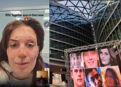 Crans Montana Niguarda, 15enne Elsa uscita dal coma,  16enni Leo e Kean comunicano tramite pc, 16enne Manfredi in attesa di intervento 