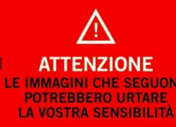 Jeffrey Epstein, le IMMAGINI subito dopo la morte in cella per impiccagione: l'uomo a torso nudo, i lividi e il cappio arancione 