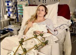 Lindsey Vonn, 4 operazioni in 6 giorni dopo caduta ad Olimpiadi Milano Cortina 2026, in Italia interventi gratuiti, in Usa costo ~$250mila