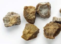 Ladri rubano "pepite" in casa, ma erano calcoli renali appena analizzati: "derubato" l'ex vicedirettore del Messaggero Veneto, Giuseppe Ragogna