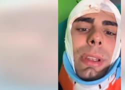 Milano banlieue, 25enne Alessandro Briguglio aggredito da due rom bosniaci per orologio Tudor da 4mila€: "Preso a martellate in testa"; arrestati - VIDEO