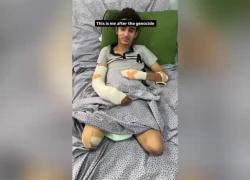 Gaza, ginnasta Ahmed Almasab perde le gambe durante bombardamento e denuncia genocidio: “Sogno di lasciare la Striscia, non distogliete lo sguardo”