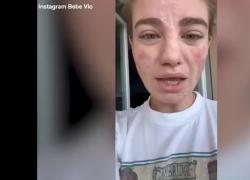Bebe Vio borseggiata al ritorno da un funerale: "Tieniti pc e soldi, ma ridammi la tesi: non posso non laurearmi!" - VIDEO
