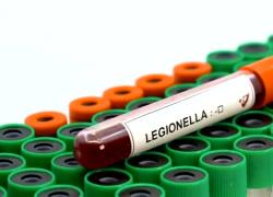 Milano, sospetto focolaio di legionella nel quartiere San Siro, 1 morto e 8 ricoverati; Ats avvia "campionamenti nelle abitazioni a rischio"