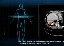Fujifilm Healthcare italia: IA per innovare la sanit&agrave; pubblica