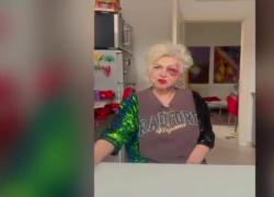 Incidente per Wanna Marchi a Milano: "Investita sulle strisce, sono caduta in avanti sul marciapiede, ho la faccia stravolta" - VIDEO