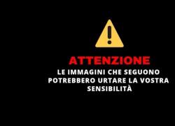 Strage ospedale Gaza, il VIDEO choc degli oltre mille morti e dei corpi dei bambini nell'obitorio