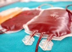 Ancona, buttati 6 quintali di sangue dall'ospedale Torrette, 1600 sacche di plasma nella spazzatura per negligenze organizzative