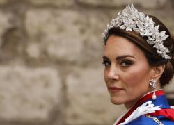 Come sta Kate Middleton, una fonte: "Perde peso e capelli, effetti collaterali della chemio molto forti" - ULTIME NOTIZIE