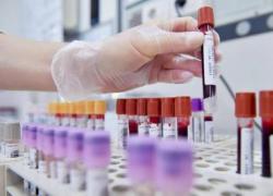 Livorno, boom di leucemie e mielomi, nel 2024 oltre 500 nuove diagnosi, il dottor Capochiani: "Aumento notevole e preoccupante dal 2020"