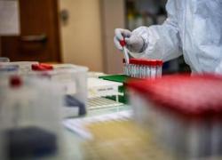 Covid Italia, avanza variante Stratus: tornano i 'vecchi' sintomi
