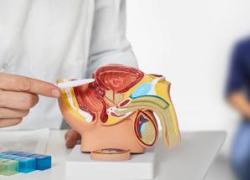 Cancro alla prostata, terapia con radioligandi riduce avanzamento malattia