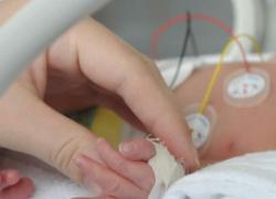 Torino, neonata di 6 giorni salvata con colla istantanea da rara malformazione vascolare al fegato che "rubava" sangue al corpo, congestionando cuore e polmoni