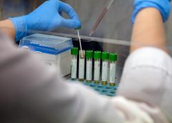Coronavirus, primo volontario sano ha ricevuto il secondo trattamento con anticorpo  