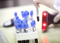 Il coronavirus 'perde pezzi': sarebbe meno letale