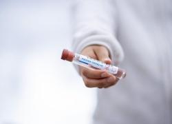 Coronavirus, i veri numeri dei contagiati in Italia