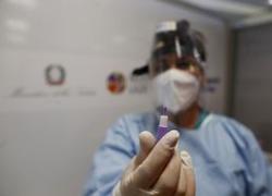 Coronavirus, Galli: 'La situazione italiana non permette di stare tranquilli'
