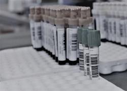 Coronavirus, Russia: primo lotto vaccino inviato a regioni