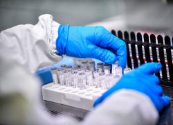 Coronavirus Usa, Fda approva trattamento remdesivir