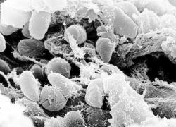Cina, un caso di peste bubbonica: ecco cos'è e come si trasmette