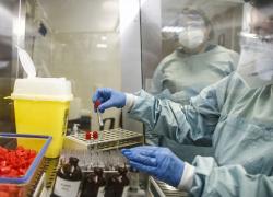 Coronavirus, Ascierto: 'Vaccino entro l'estate, iniziata fase 1 sui pazienti'