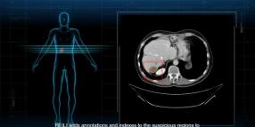 Fujifilm Healthcare italia: IA per innovare la sanit&agrave; pubblica