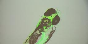 Tecnologie e Intelligenza Artificiale al servizio del paziente 