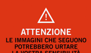 Gaza City, 3 bambine palestinesi ferite da raid Idf nel quartiere di Sheijaya, insanguinate e bendate dai medici - VIDEO