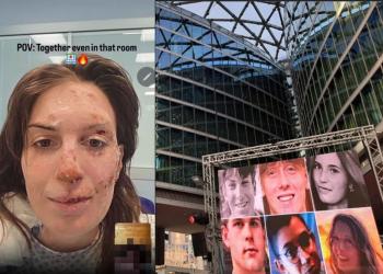 Crans Montana Niguarda, 15enne Elsa uscita dal coma, 16enni Leo e Kean comunicano tramite pc, 16enne Manfredi in attesa di intervento