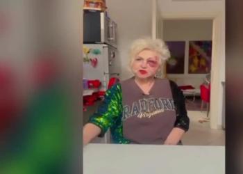 Incidente per Wanna Marchi a Milano: "Investita sulle strisce, sono caduta in avanti sul marciapiede, ho la faccia stravolta" - VIDEO