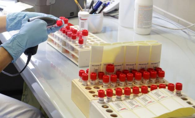 Malattie sessualmente trasmissibili +30% nella fase post Covid