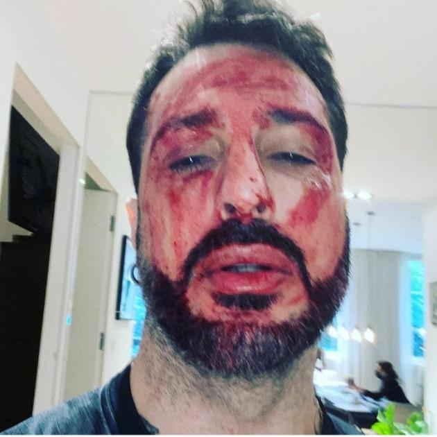 Fabrizio Corona arrestato, immagini choc su Instagram: insanguinato a terra