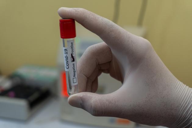 ritrovate le sequenze del virus cancellate dai ricercatori cinesi 