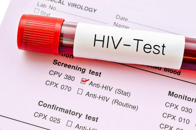 Aids: cause, cure e sintomi della malattia che ha segnato il XX secolo