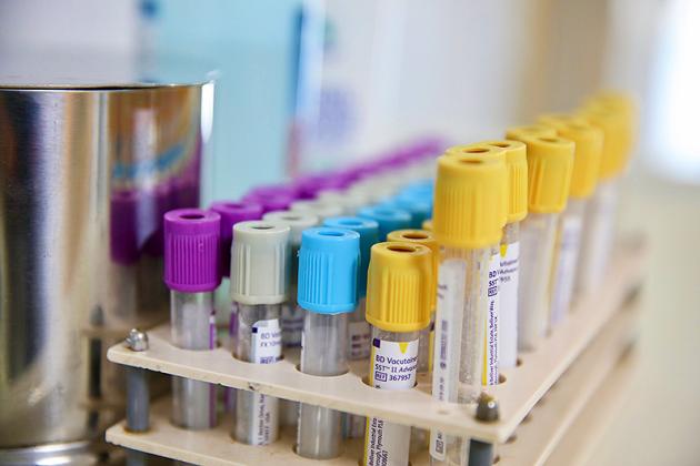 Omicron, studi britannici rivelano ricoveri più bassi per i casi di infezione